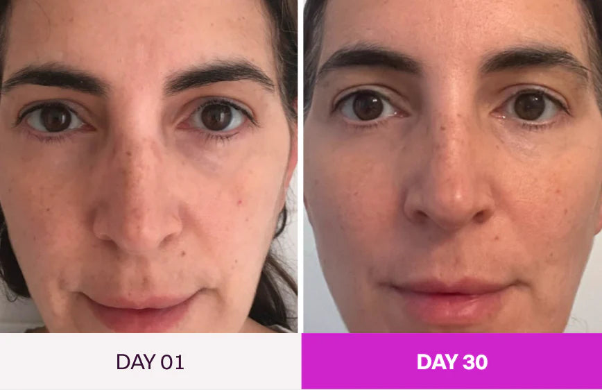 Before and After