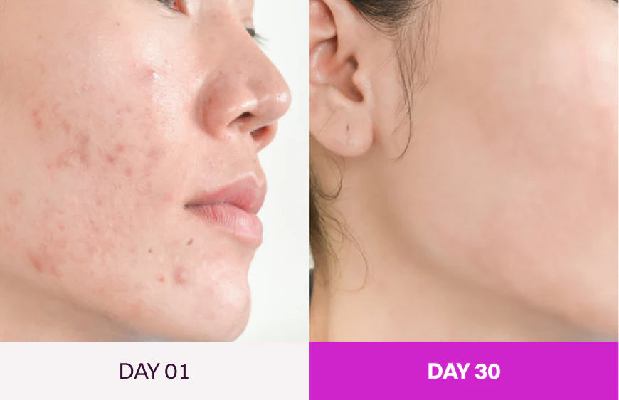 Before and After