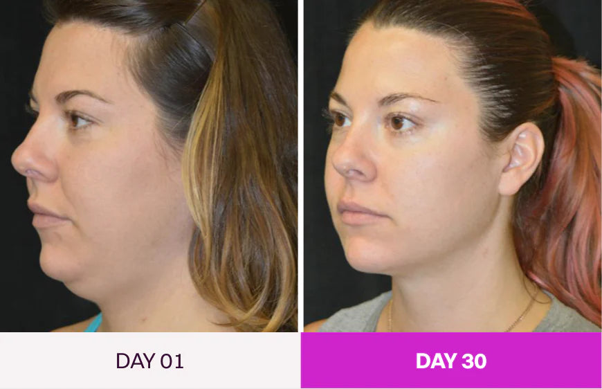 Before and After