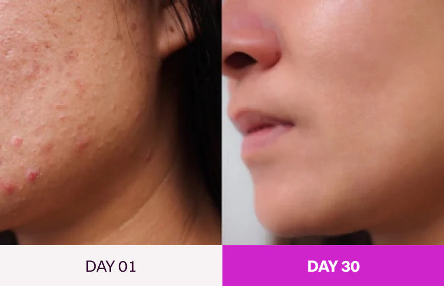 Before and After